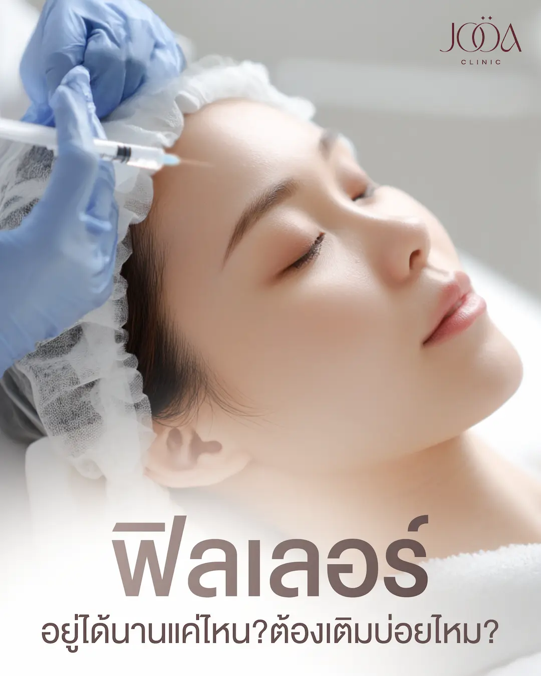 ฟิลเลอร์อยู่ได้นานแค่ไหน